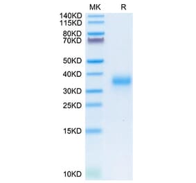 Tris-Bis PAGE - Recombinant Human CD74 Protein (N-terminal His Tag) (A330397) - Antibodies.com