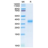 Tris-Bis PAGE - Recombinant Human CD74 Protein (N-terminal His Tag) (A330397) - Antibodies.com
