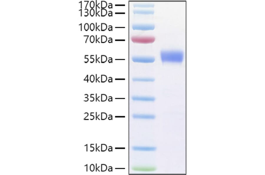 SDS-PAGE - Recombinant Human CD79b Protein (C-terminal Human Fc Tag) (A330398) - Antibodies.com