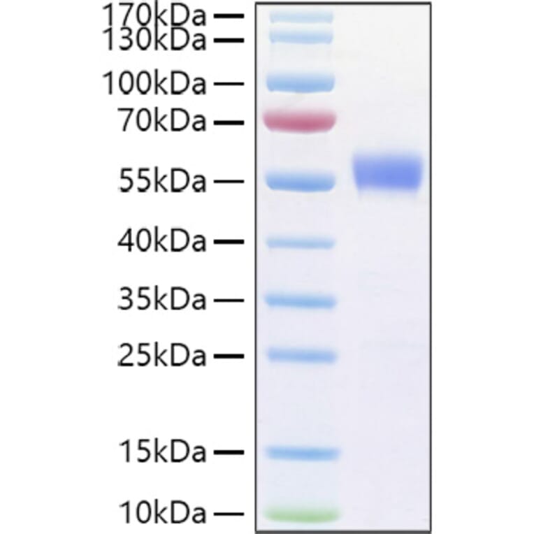 SDS-PAGE - Recombinant Human CD79b Protein (C-terminal Human Fc Tag) (A330398) - Antibodies.com