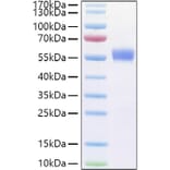SDS-PAGE - Recombinant Human CD79b Protein (C-terminal Human Fc Tag) (A330398) - Antibodies.com