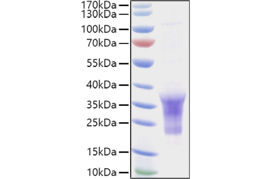 SDS-PAGE - Recombinant Human CD79b Protein (C-terminal His Tag) (A330399) - Antibodies.com