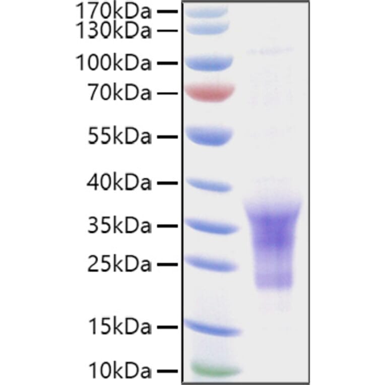 SDS-PAGE - Recombinant Human CD79b Protein (C-terminal His Tag) (A330399) - Antibodies.com