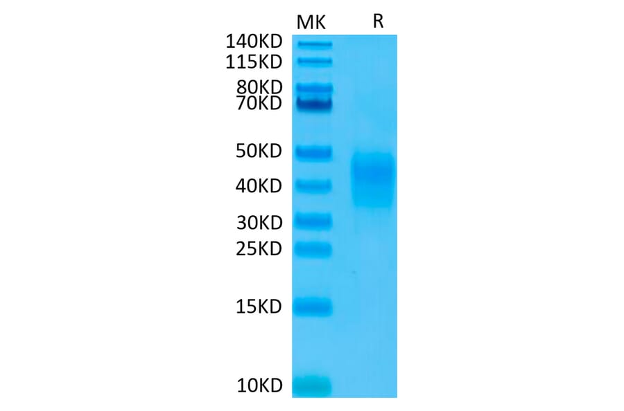 Tris-Bis PAGE - Recombinant Human CD79b Protein (Biotin) (C-terminal His and Avi Tag) (A330400) - Antibodies.com