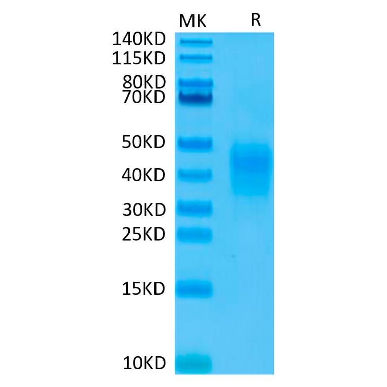 Tris-Bis PAGE - Recombinant Human CD79b Protein (Biotin) (C-terminal His and Avi Tag) (A330400) - Antibodies.com