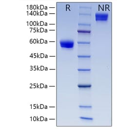 SDS-PAGE - Recombinant Human CD8 alpha Protein (C-terminal Human Fc and His Tag) (A330401) - Antibodies.com