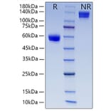SDS-PAGE - Recombinant Human CD8 alpha Protein (C-terminal Human Fc and His Tag) (A330401) - Antibodies.com