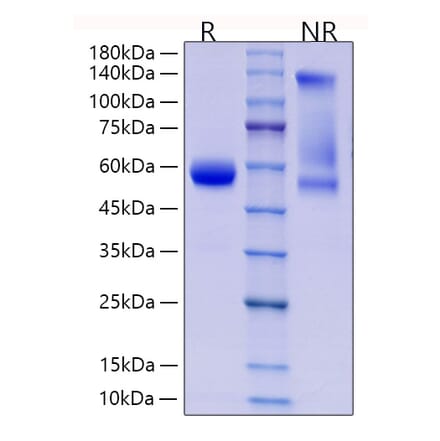 SDS-PAGE - Recombinant Human CD8 alpha Protein (C-terminal Rabbit Fc Tag) (A330402) - Antibodies.com