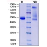 SDS-PAGE - Recombinant Human CD8 alpha Protein (C-terminal Rabbit Fc Tag) (A330402) - Antibodies.com