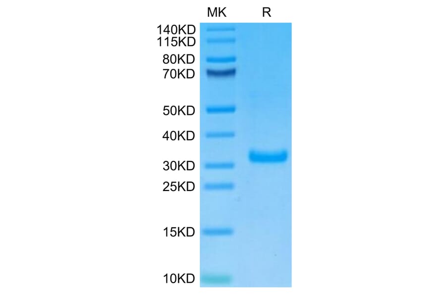 Tris-Bis PAGE - Recombinant Human CD8 alpha Protein (Biotin) (C-terminal His and Avi Tag) (A330403) - Antibodies.com
