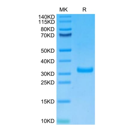 Tris-Bis PAGE - Recombinant Human CD8 alpha Protein (Biotin) (C-terminal His and Avi Tag) (A330403) - Antibodies.com
