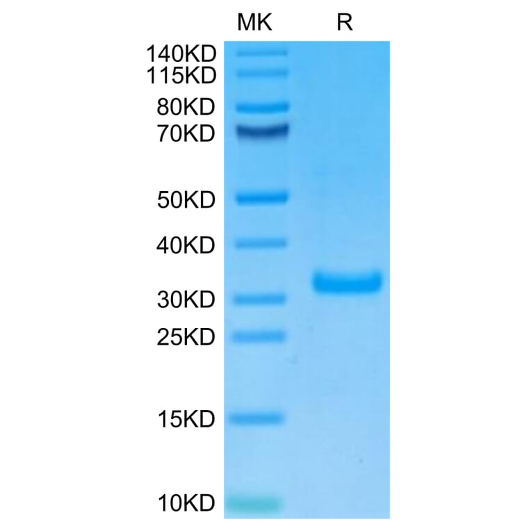 Tris-Bis PAGE - Recombinant Human CD8 alpha Protein (Biotin) (C-terminal His and Avi Tag) (A330403) - Antibodies.com