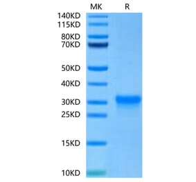 Tris-Bis PAGE - Recombinant Human CD8 alpha Protein (C-terminal His Tag) (A330404) - Antibodies.com