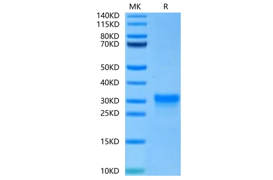 Tris-Bis PAGE - Recombinant Human CD8 alpha Protein (C-terminal His Tag) (A330404) - Antibodies.com