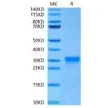 Tris-Bis PAGE - Recombinant Human CD8 alpha Protein (C-terminal His Tag) (A330404) - Antibodies.com