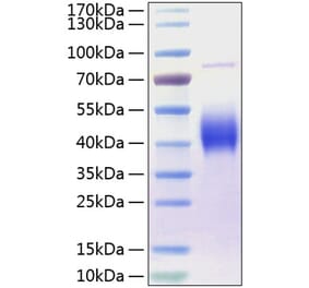 SDS-PAGE - Recombinant Human CD80 Protein (C-terminal His Tag) (A330405) - Antibodies.com