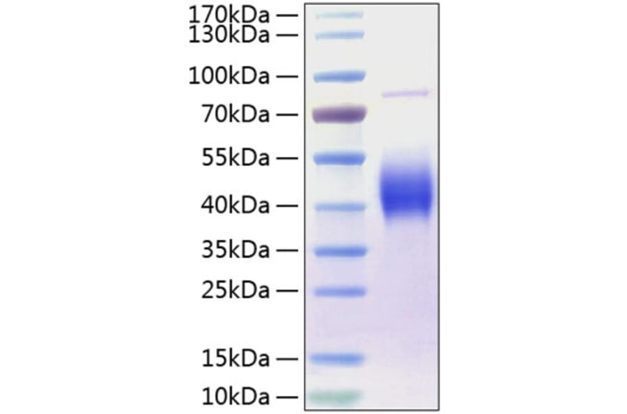 SDS-PAGE - Recombinant Human CD80 Protein (C-terminal His Tag) (A330405) - Antibodies.com