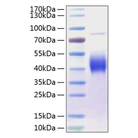 SDS-PAGE - Recombinant Human CD80 Protein (C-terminal His Tag) (A330405) - Antibodies.com