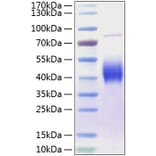 SDS-PAGE - Recombinant Human CD80 Protein (C-terminal His Tag) (A330405) - Antibodies.com