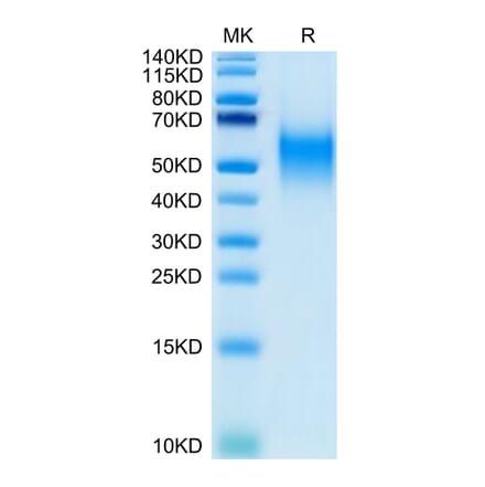 Tris-Bis PAGE - Recombinant Human CD80 Protein (Biotin) (C-terminal His and Avi Tag) (A330406) - Antibodies.com