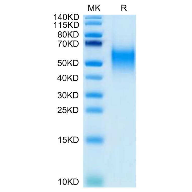 Tris-Bis PAGE - Recombinant Human CD80 Protein (Biotin) (C-terminal His and Avi Tag) (A330406) - Antibodies.com