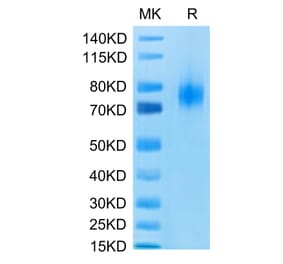 Tris-Bis PAGE - Recombinant Human CD80 Protein (C-terminal Human Fc Tag) (A330407) - Antibodies.com