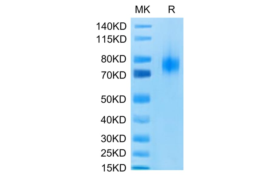 Tris-Bis PAGE - Recombinant Human CD80 Protein (C-terminal Human Fc Tag) (A330407) - Antibodies.com