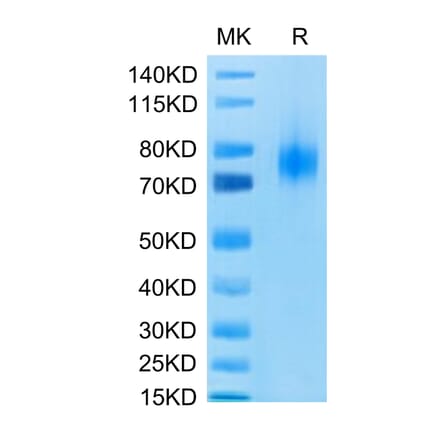 Tris-Bis PAGE - Recombinant Human CD80 Protein (C-terminal Human Fc Tag) (A330407) - Antibodies.com