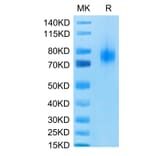 Tris-Bis PAGE - Recombinant Human CD80 Protein (C-terminal Human Fc Tag) (A330407) - Antibodies.com
