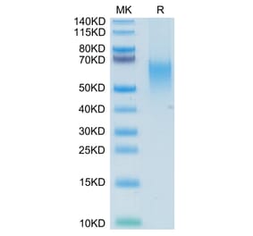 Tris-Bis PAGE - Recombinant Human CD80 Protein (C-terminal His and Avi Tag) (A330408) - Antibodies.com