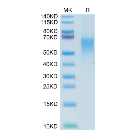 Tris-Bis PAGE - Recombinant Human CD80 Protein (C-terminal His and Avi Tag) (A330408) - Antibodies.com