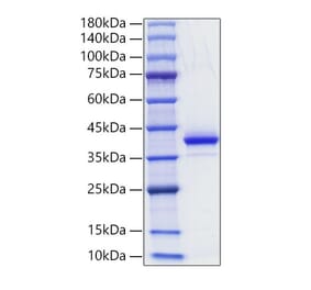 SDS-PAGE - Recombinant Human CD81 Protein (N-terminal Human Fc Tag) (A330409) - Antibodies.com