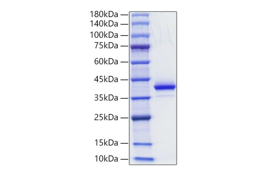 SDS-PAGE - Recombinant Human CD81 Protein (N-terminal Human Fc Tag) (A330409) - Antibodies.com