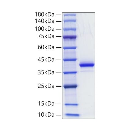 SDS-PAGE - Recombinant Human CD81 Protein (N-terminal Human Fc Tag) (A330409) - Antibodies.com