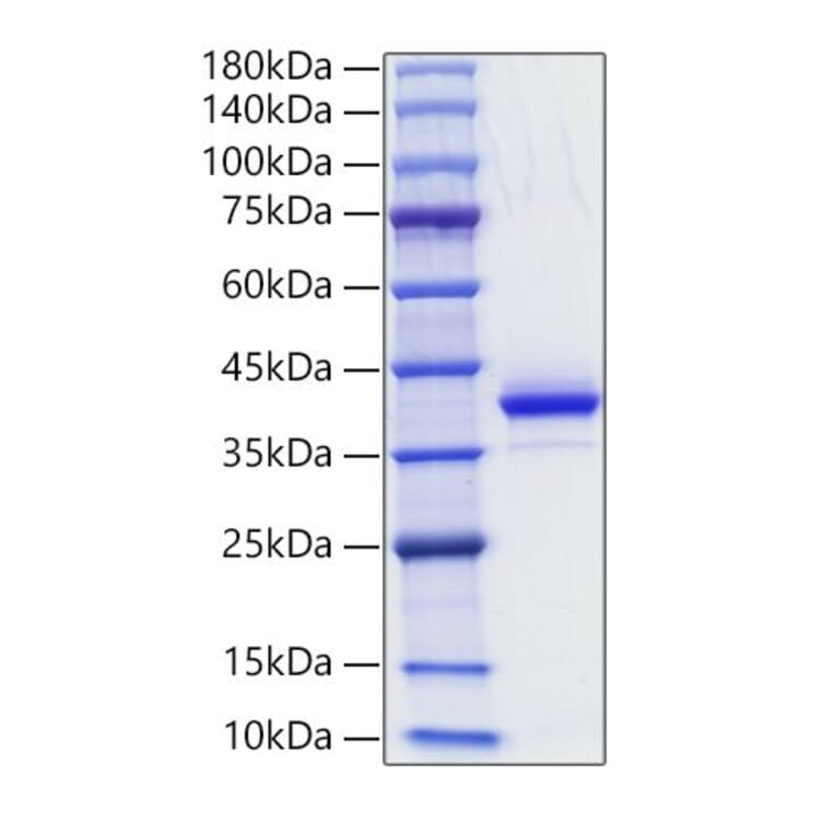 SDS-PAGE - Recombinant Human CD81 Protein (N-terminal Human Fc Tag) (A330409) - Antibodies.com