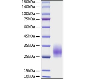 SDS-PAGE - Recombinant Mouse CD83 Protein (C-terminal His Tag) (A330410) - Antibodies.com
