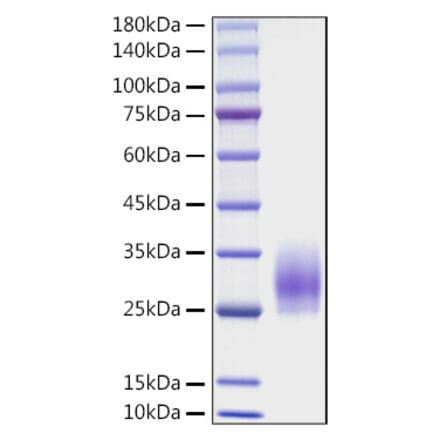 SDS-PAGE - Recombinant Mouse CD83 Protein (C-terminal His Tag) (A330410) - Antibodies.com