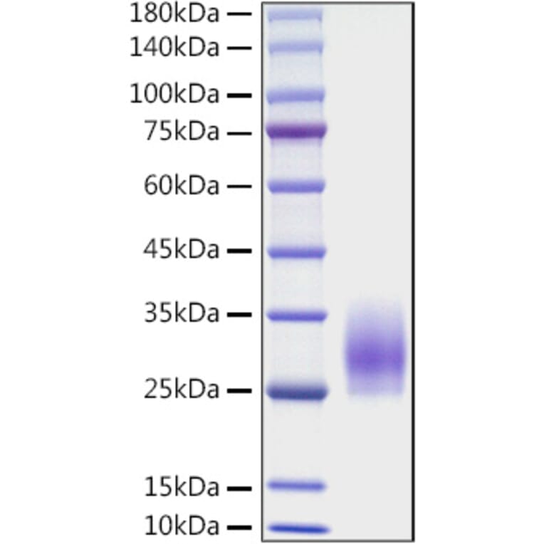SDS-PAGE - Recombinant Mouse CD83 Protein (C-terminal His Tag) (A330410) - Antibodies.com
