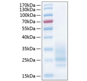 SDS-PAGE - Recombinant Human CD83 Protein (C-terminal His Tag) (A330411) - Antibodies.com