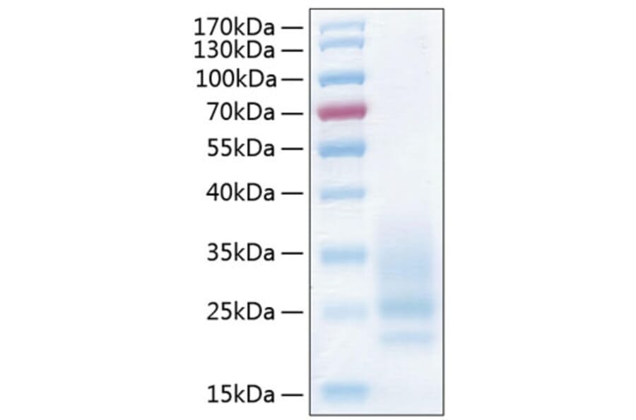 SDS-PAGE - Recombinant Human CD83 Protein (C-terminal His Tag) (A330411) - Antibodies.com
