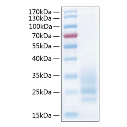 SDS-PAGE - Recombinant Human CD83 Protein (C-terminal His Tag) (A330411) - Antibodies.com
