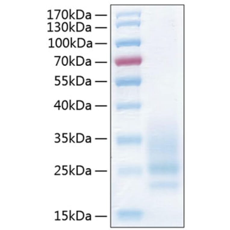 SDS-PAGE - Recombinant Human CD83 Protein (C-terminal His Tag) (A330411) - Antibodies.com