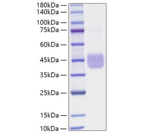 SDS-PAGE - Recombinant Human CD84 Protein (C-terminal His Tag) (A330412) - Antibodies.com