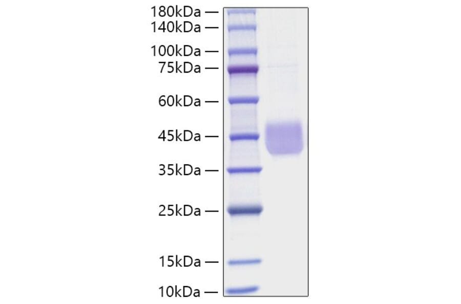 SDS-PAGE - Recombinant Human CD84 Protein (C-terminal His Tag) (A330412) - Antibodies.com