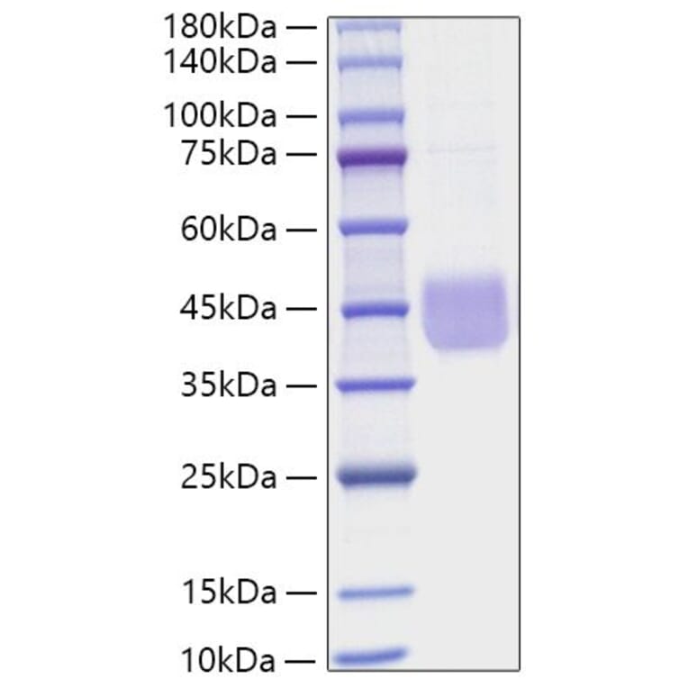 SDS-PAGE - Recombinant Human CD84 Protein (C-terminal His Tag) (A330412) - Antibodies.com