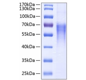 SDS-PAGE - Recombinant Human CD86 Protein (C-terminal His Tag) (A330413) - Antibodies.com