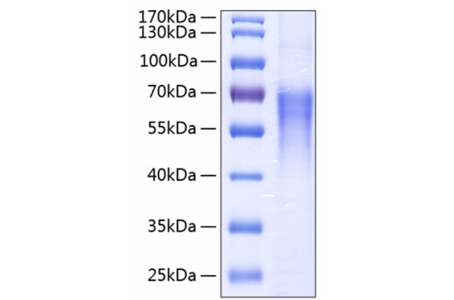 SDS-PAGE - Recombinant Human CD86 Protein (C-terminal His Tag) (A330413) - Antibodies.com