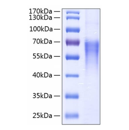 SDS-PAGE - Recombinant Human CD86 Protein (C-terminal His Tag) (A330413) - Antibodies.com
