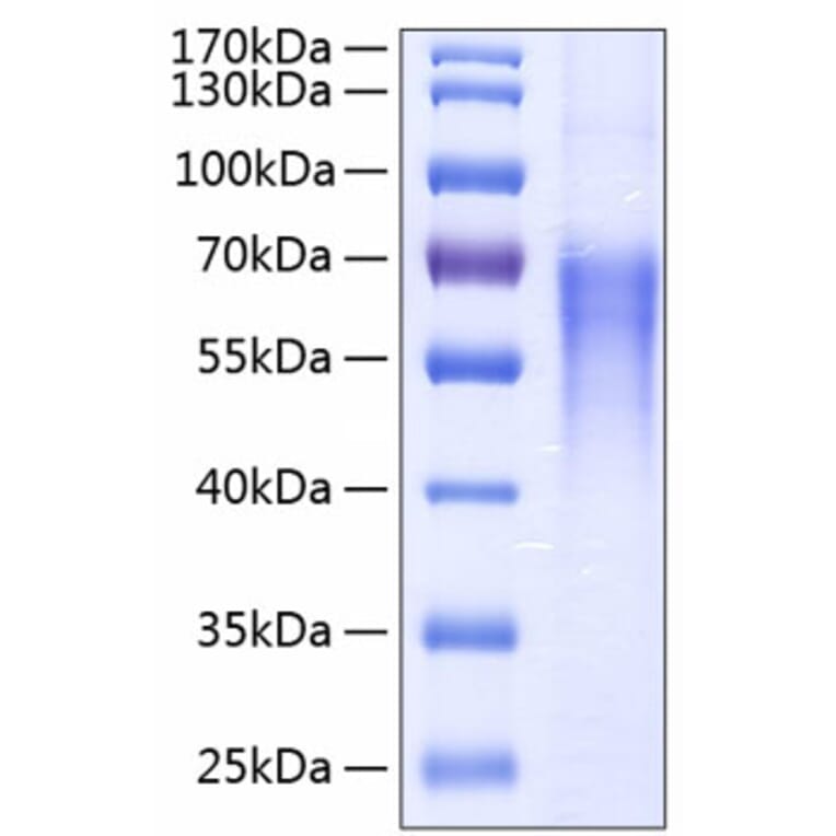 SDS-PAGE - Recombinant Human CD86 Protein (C-terminal His Tag) (A330413) - Antibodies.com