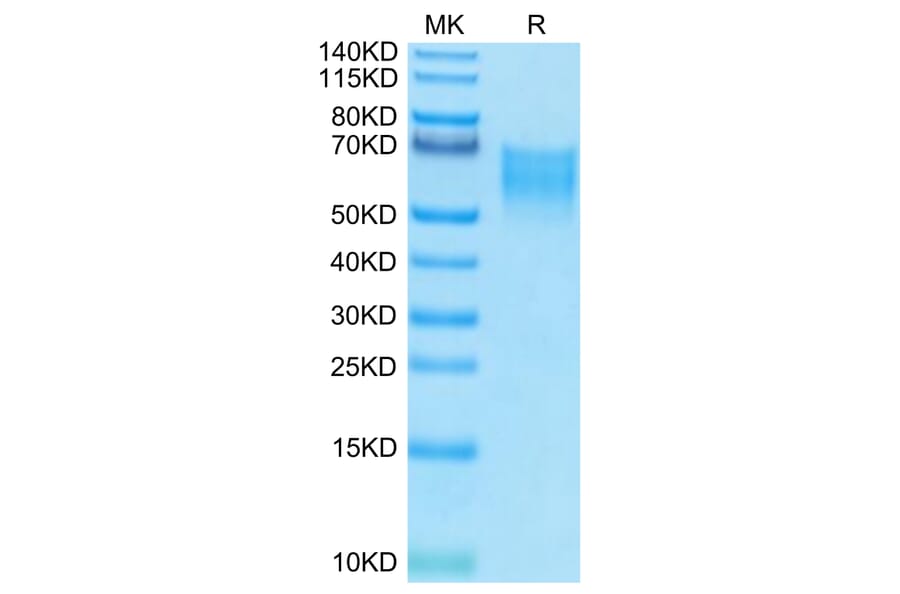 Tris-Bis PAGE - Recombinant Human CD86 Protein (Biotin) (C-terminal His and Avi Tag) (A330414) - Antibodies.com